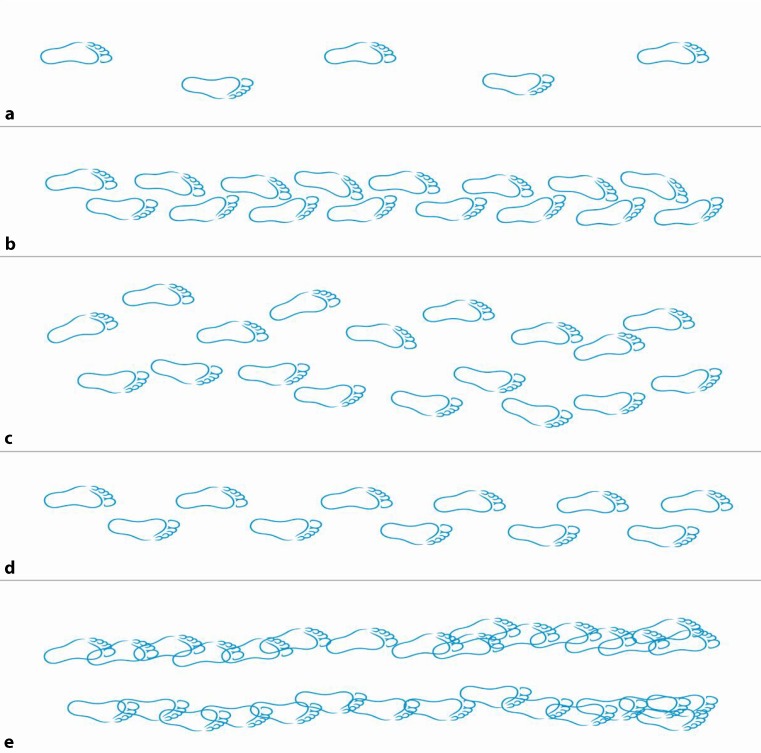 Graphic representation of step sequences in classical gait disorders comparing normal, spastic paraparetic, cerebellar ataxic, parkinsonian, and frontal gait patterns