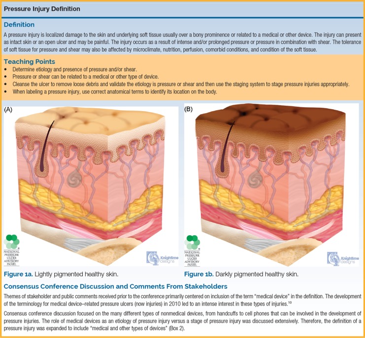 Clinical photograph and cross-sectional diagram of Stage 1 pressure injury showing non-blanchable erythema of intact skin over a bony prominence