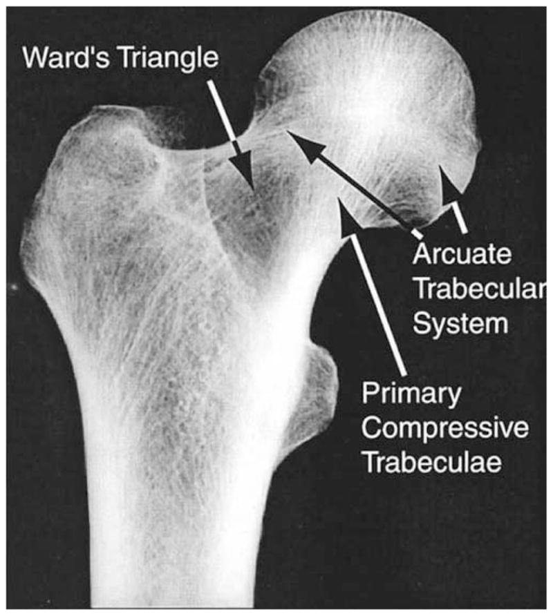 Radiographic frontal view of the proximal femur showing regional density variations and microstructural characteristics relevant to osteoporotic fracture risk