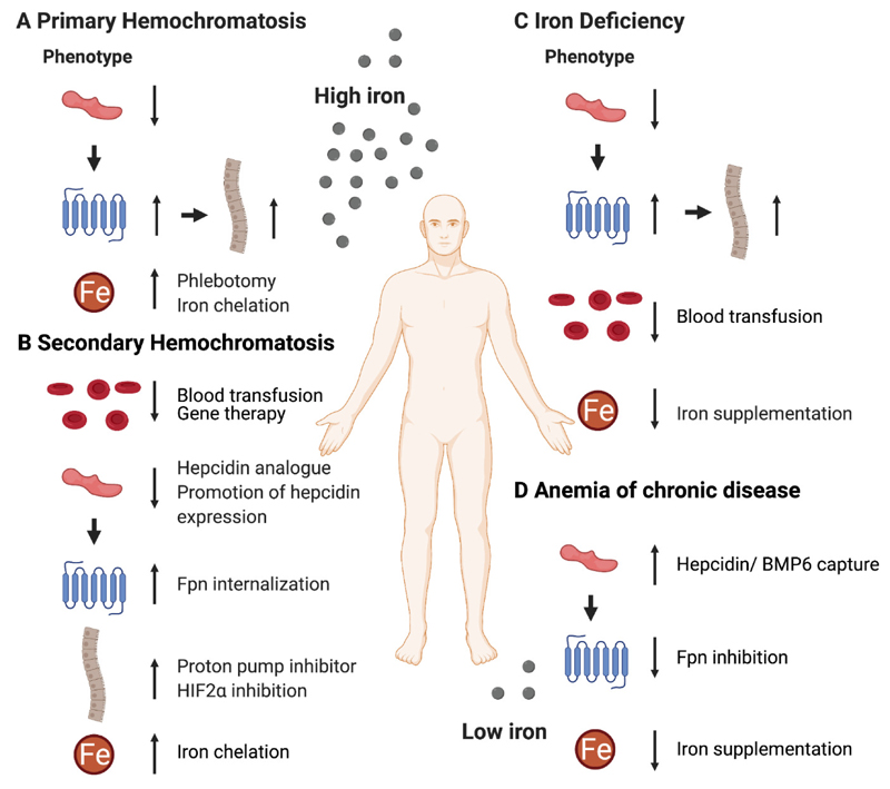 Therapeutic strategies targeting iron metabolism in hematologic disorders