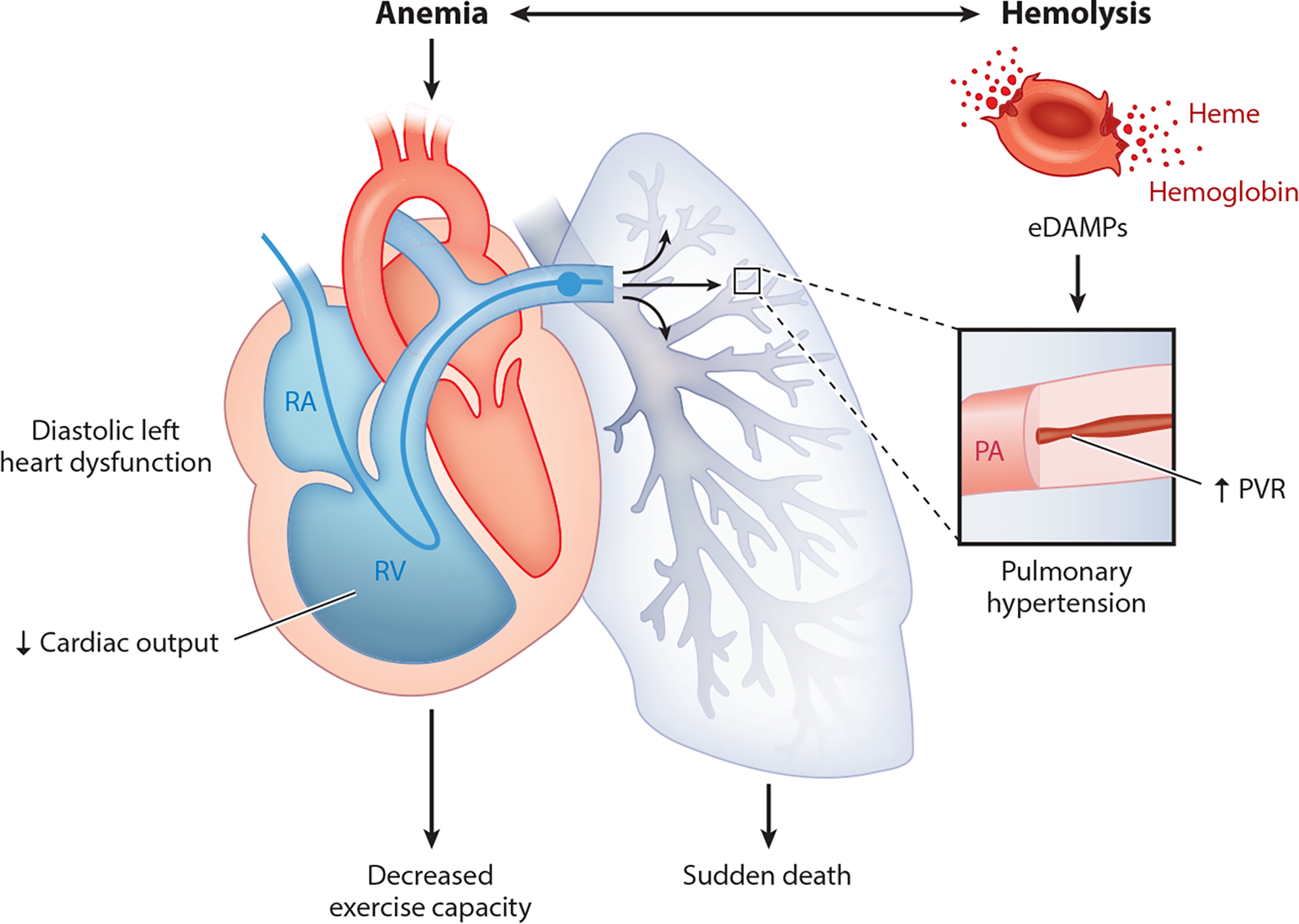 Endothelial dysfunction and vascular pathology in sickle cell disease