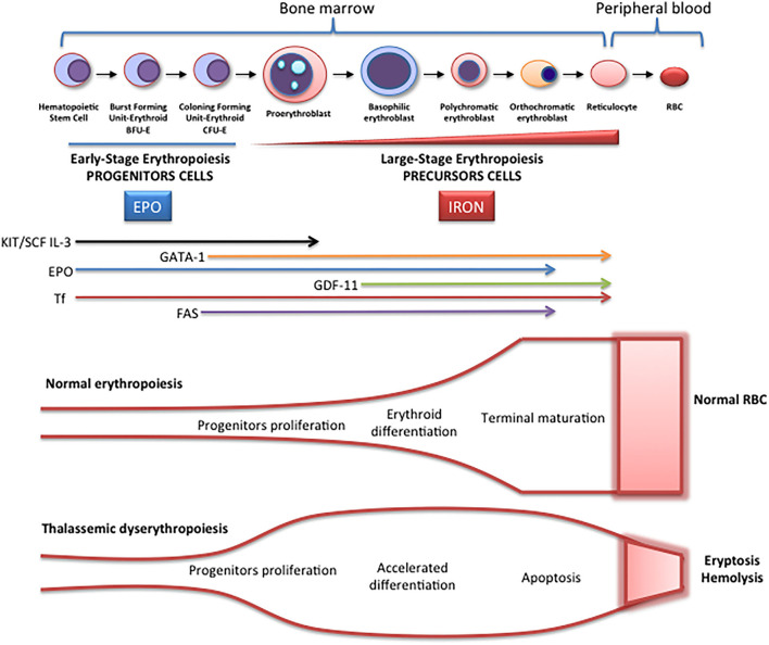 Ineffective erythropoiesis and iron overload mechanisms in beta-thalassemia