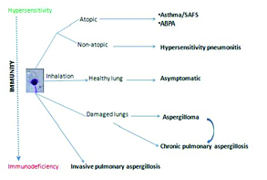 Spectrum of pulmonary aspergillosis in relation to host immune status