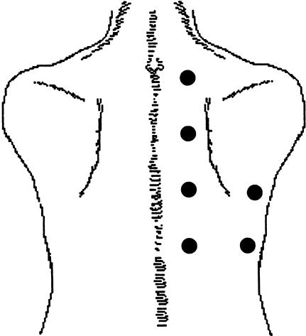 Diagram showing posterior chest auscultation points for lung sounds