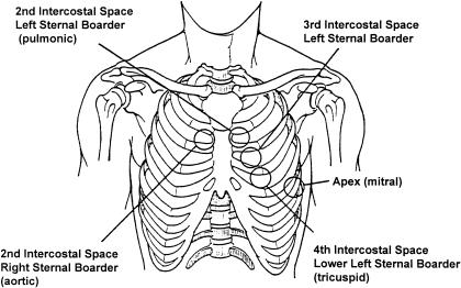 Diagram showing the standard cardiac auscultation landmark points on the anterior chest wall