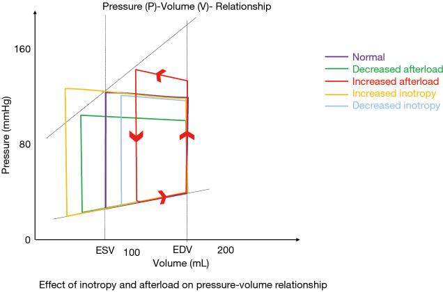 Diagram of neurohormonal activation pathways in heart failure