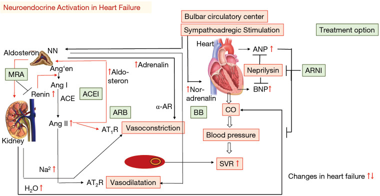 Diagram showing cardiac remodeling in heart failure with comparison of normal, dilated, and hypertrophied ventricles