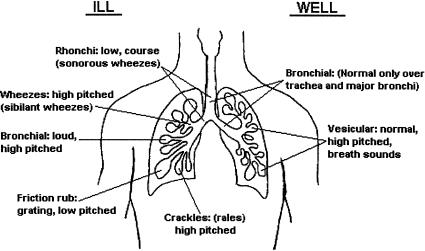 Graphic representation comparing normal and abnormal breath sounds