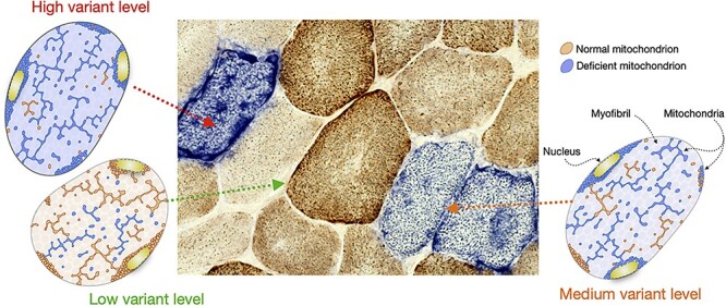 Diagram showing mitochondrial DNA heteroplasmy, threshold effect, and tissue-specific oxidative phosphorylation deficiency