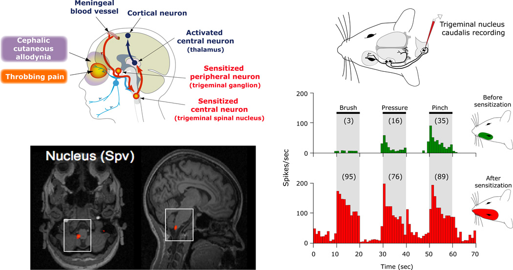 Diagram showing peripheral and central sensitization in migraine pathophysiology