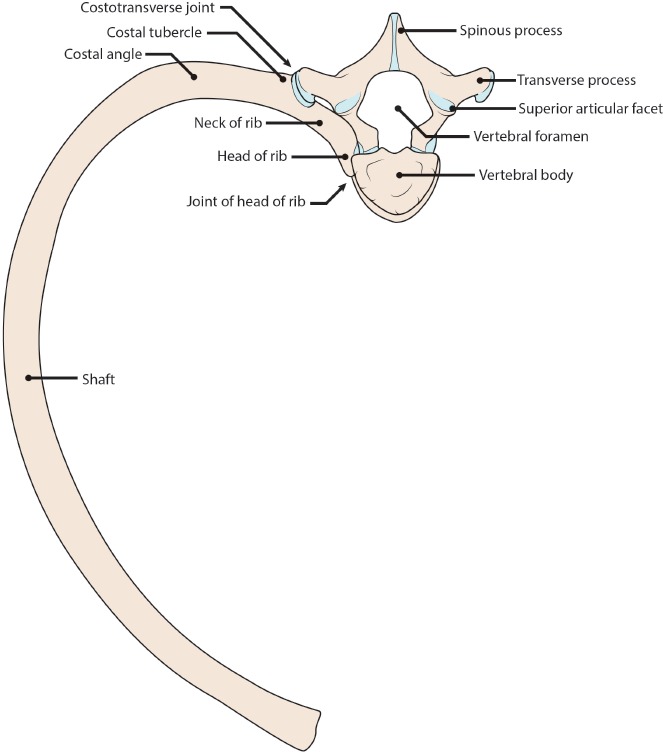 Anatomy of a rib showing classic sites of fracture from external force application in child abuse