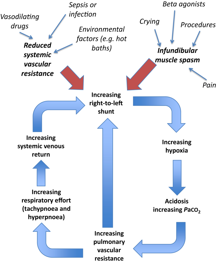 Diagram showing the mechanism and downward spiral of a hypercyanotic (tet) spell in Tetralogy of Fallot