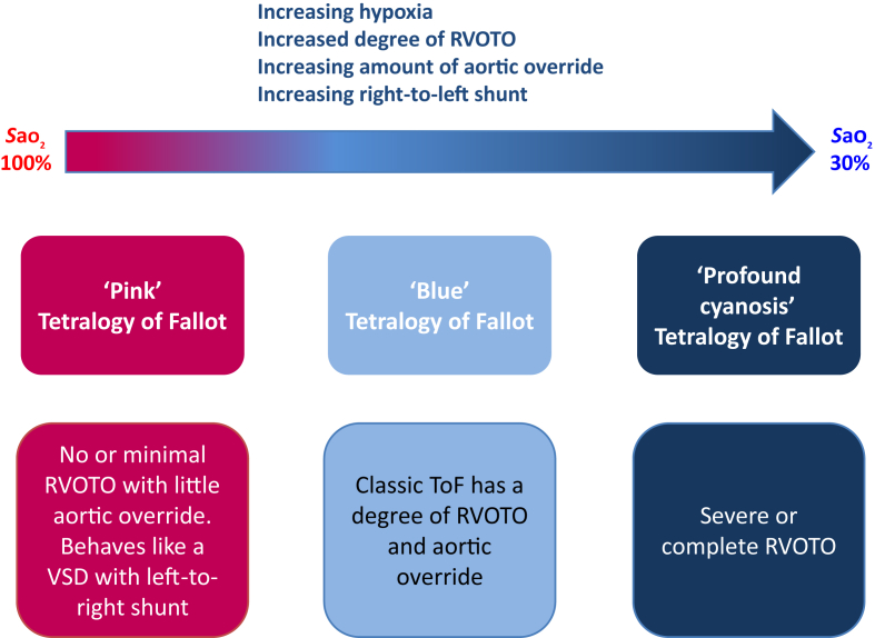 Diagram showing different anatomical and pathophysiological variants of Tetralogy of Fallot including acyanotic and cyanotic forms