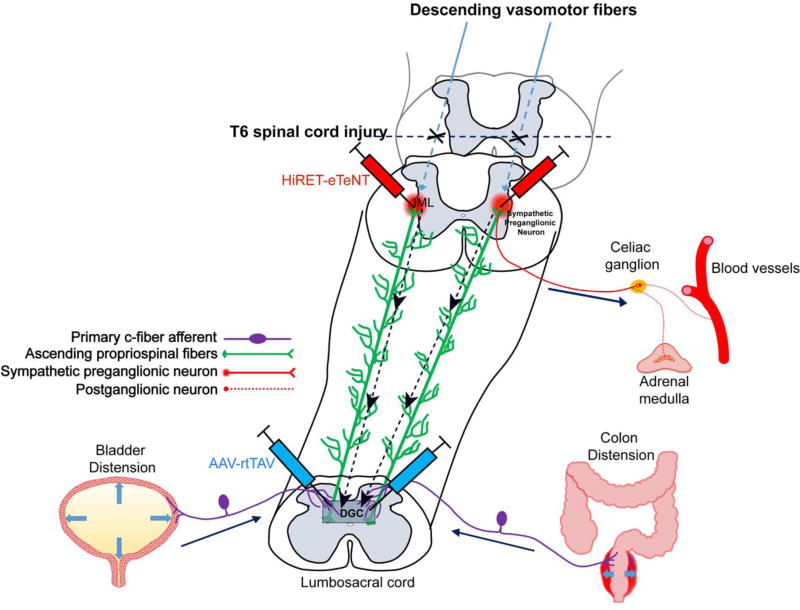 Neuroanatomical diagram showing the mechanism of autonomic dysreflexia with sympathetic and parasympathetic pathways in spinal cord injury