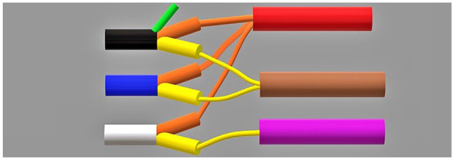 Three-dimensional illustration of brachial plexus trunks, divisions, and cords showing spatial relationships