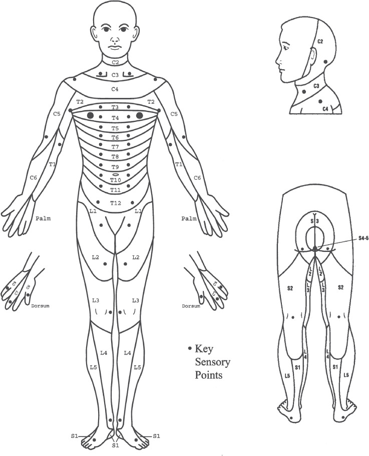 ISNCSCI key sensory points diagram showing dermatome testing locations on the human body
