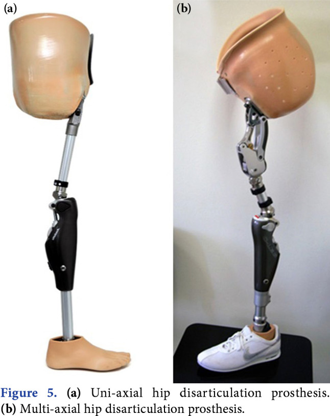 Hip disarticulation prostheses showing uni-axial and multi-axial designs with Canadian-type sockets