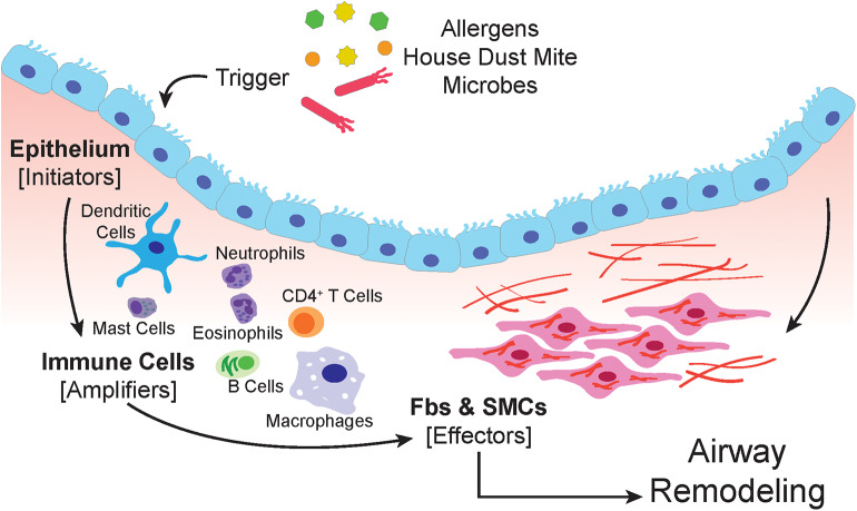 Diagram of asthma pathophysiology showing airway inflammation, epithelial damage, smooth muscle hypertrophy, and mucus hypersecretion
