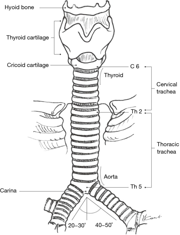 Bronchoscopic view of the tracheobronchial tree showing the carina and bilateral mainstem bronchi
