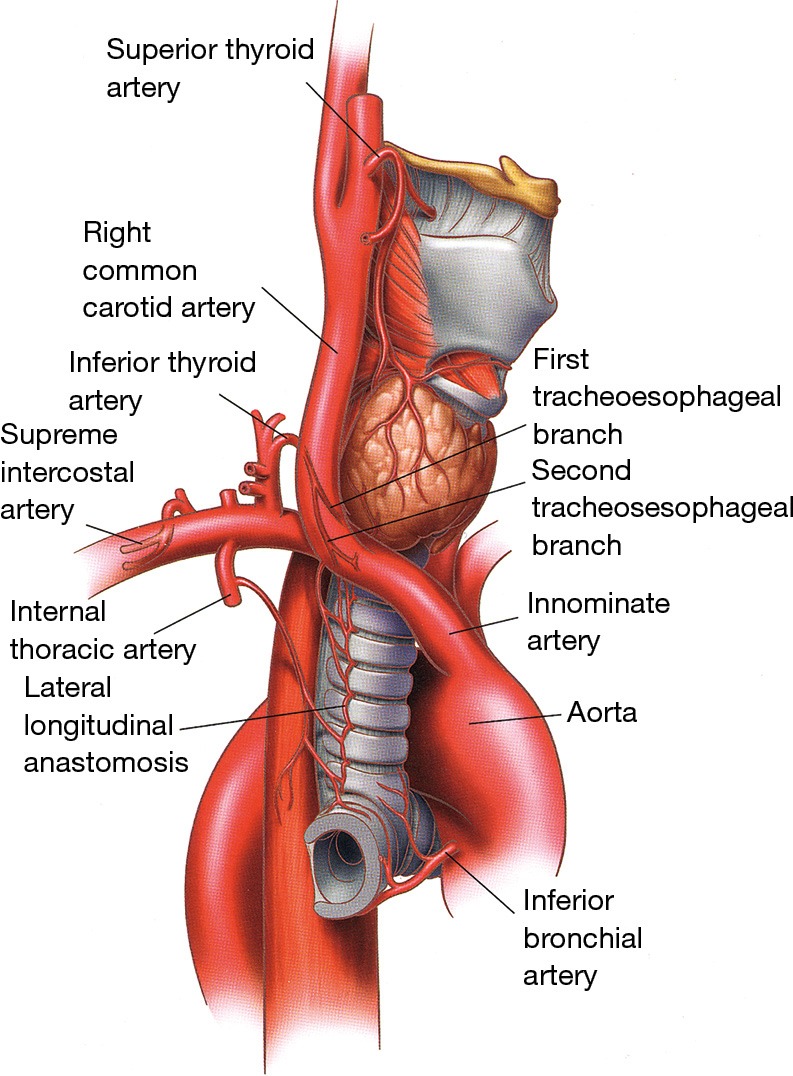 Normal chest radiograph anatomy with labeled structures including trachea, bronchi, lung fields, and mediastinum