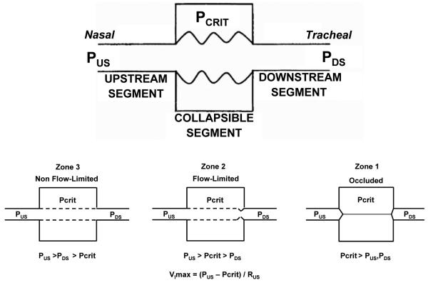 Starling resistor model diagram of upper airway collapse in obstructive sleep apnea