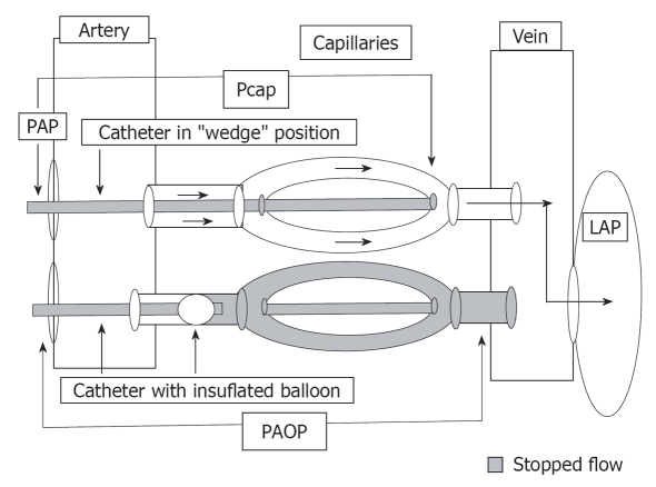 Diagram of right heart catheterization hemodynamic tracings in pulmonary hypertension