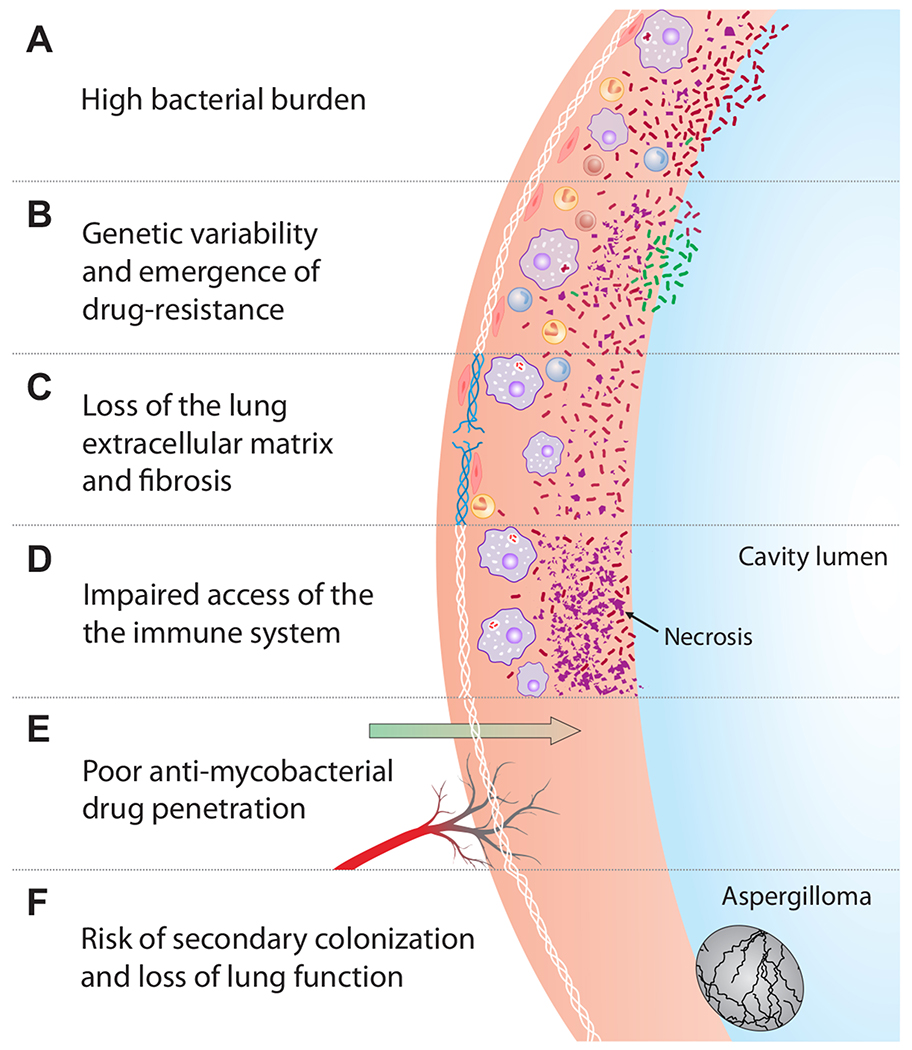 Diagram of tuberculosis pathogenesis showing primary infection, latent TB, and reactivation pathways