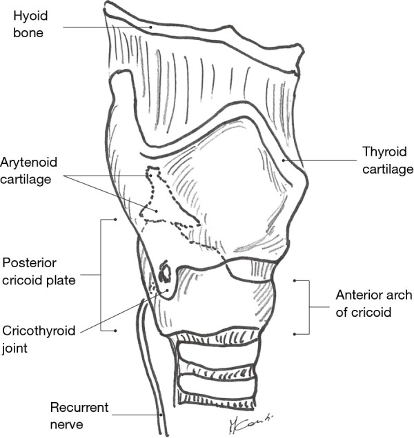 Pulmonary vascular anatomy showing pulmonary arteries, veins, and bronchial arteries