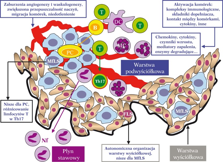 Diagram of the immune-inflammatory response in rheumatoid arthritis showing interactions between T cells, B cells, macrophages, and cytokines in the synovium