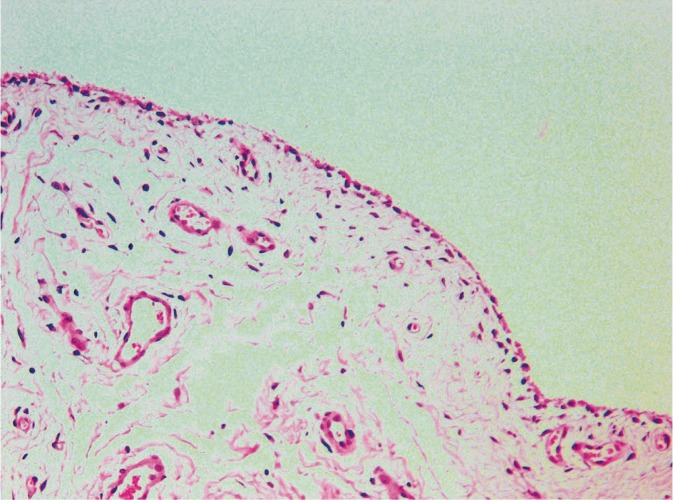 Histological diagram of the synovial membrane showing type A and type B synoviocytes, subintimal connective tissue, and vascular supply