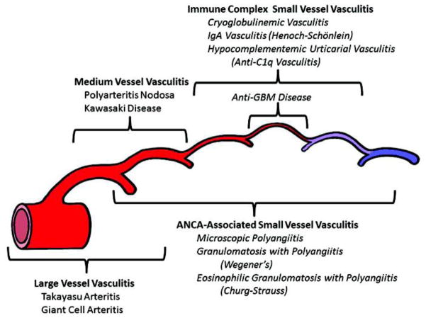 Diagram showing the Chapel Hill Consensus Conference classification of vasculitis by vessel size, depicting large, medium, and small vessel involvement patterns