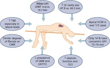 Comparison of diagnostic characteristics between athletes with HCM and sedentary patients with HCM