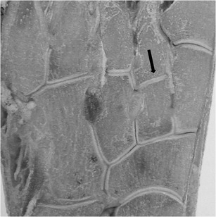 Anatomy of the Lisfranc joint showing the second metatarsal keystone recessed between the cuneiforms