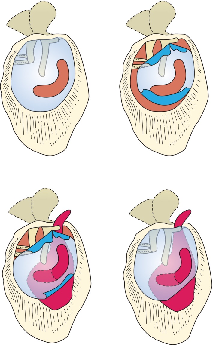Middle ear anatomy showing tympanic cavity, ossicles, and related structures
