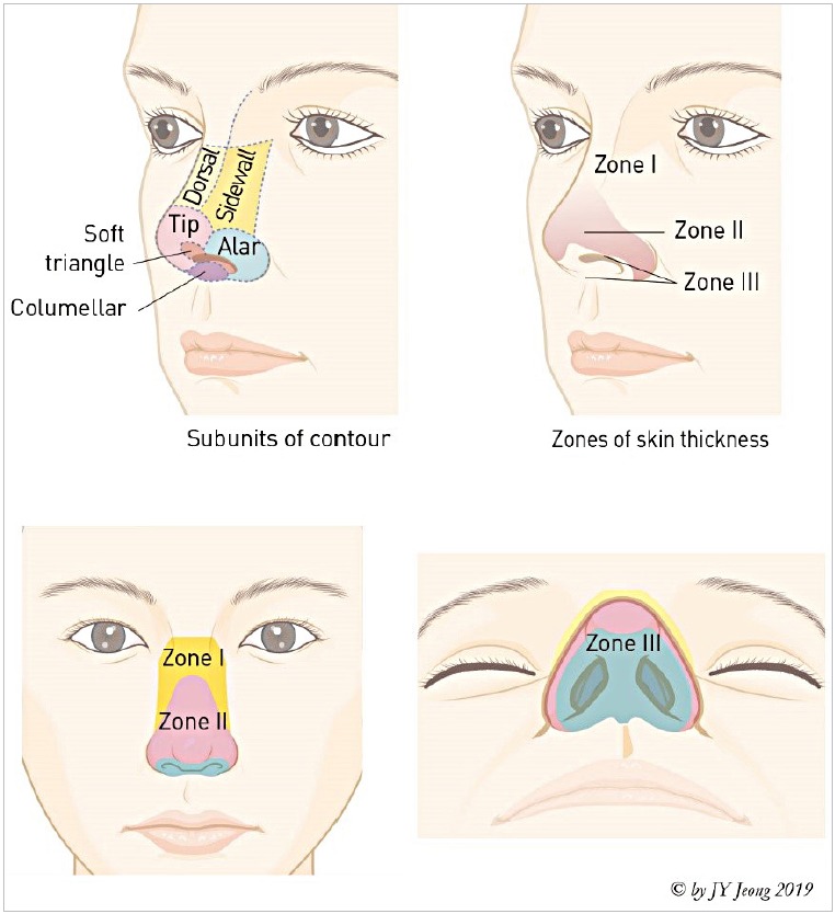 Nasal septum anatomy showing quadrangular cartilage, perpendicular plate, and vomer