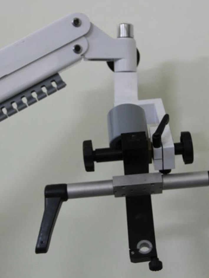 Otoscopic view of normal tympanic membrane showing key landmarks