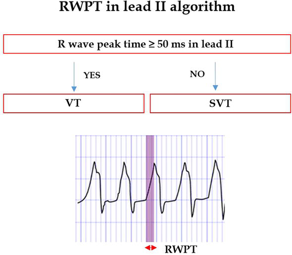 Syncope evaluation algorithm showing initial assessment risk stratification and diagnostic pathway