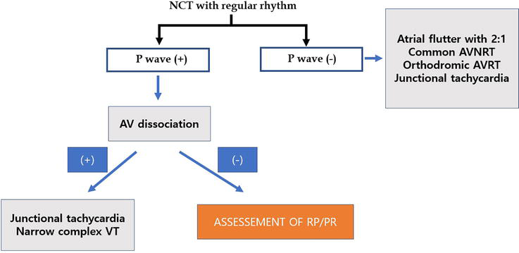 Wide complex tachycardia differential diagnosis algorithm VT versus SVT with aberrancy