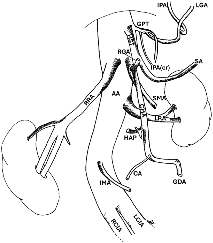Abdominal aorta and major branch vessels anatomy for interventional radiology