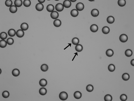 TheraSphere glass microspheres containing Yttrium-90 for transarterial radioembolization