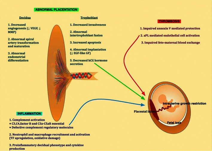 Diagram showing pathogenic mechanisms of obstetric antiphospholipid syndrome including placental thrombosis and inflammation