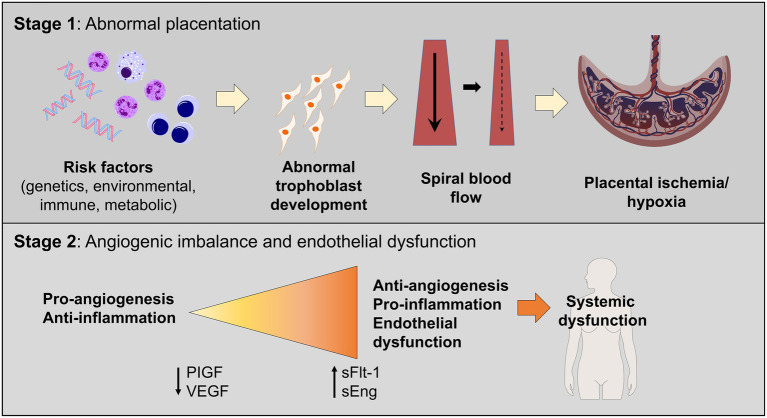 Two-stage model of preeclampsia pathogenesis showing abnormal placentation leading to maternal systemic endothelial dysfunction