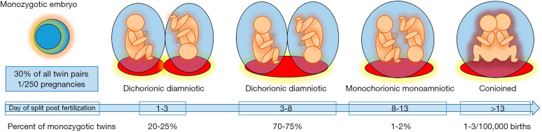 Timeline diagram showing relationship between timing of monozygotic embryo division and resulting chorionicity and amnionicity