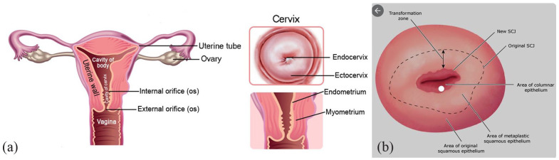 Cervical anatomy showing squamocolumnar junction and transformation zone