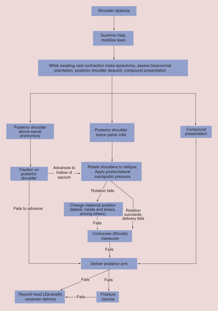 Management algorithm for shoulder dystocia showing stepwise approach from McRoberts to delivery of posterior arm