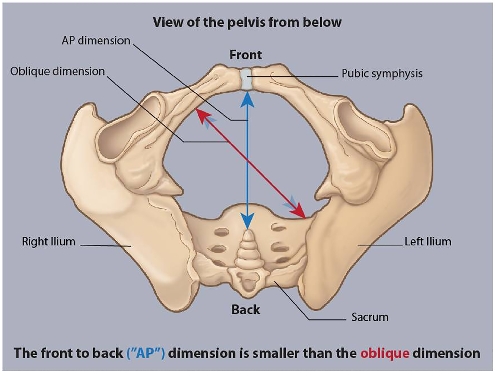Anatomical illustration of fetal shoulder impaction at the pubic symphysis during shoulder dystocia