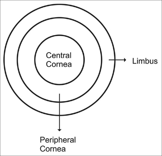 Diagram showing the central and peripheral cornea with limbal transition zone and optical characteristics