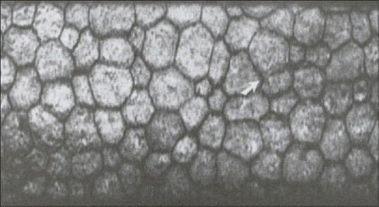 Specular microscopy image showing hexagonal endothelial cell mosaic of the cornea