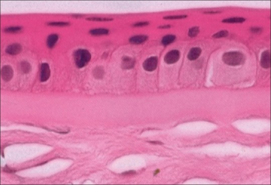 High-magnification image showing corneal epithelium and Bowman membrane with cellular detail