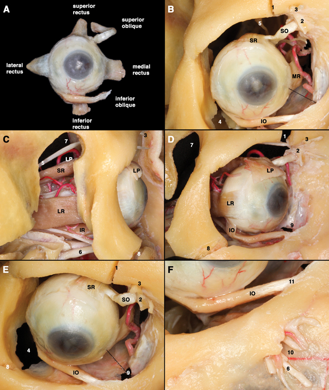 Anatomical diagram showing the extraocular muscles within the orbit and their relationships to orbital structures